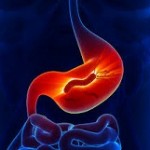 Obezite-H_-pylori-150x150