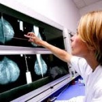 mamografi-3-150x150