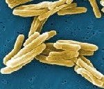 Mycobacterium-abscessus-150x129